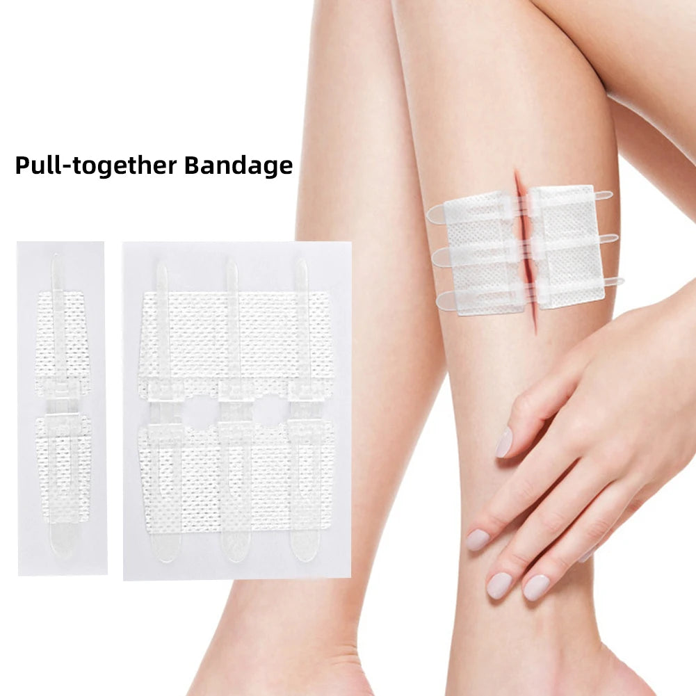 Emergency Laceration Closure Strips
