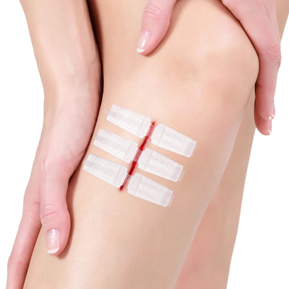 Emergency Laceration Closure Strips