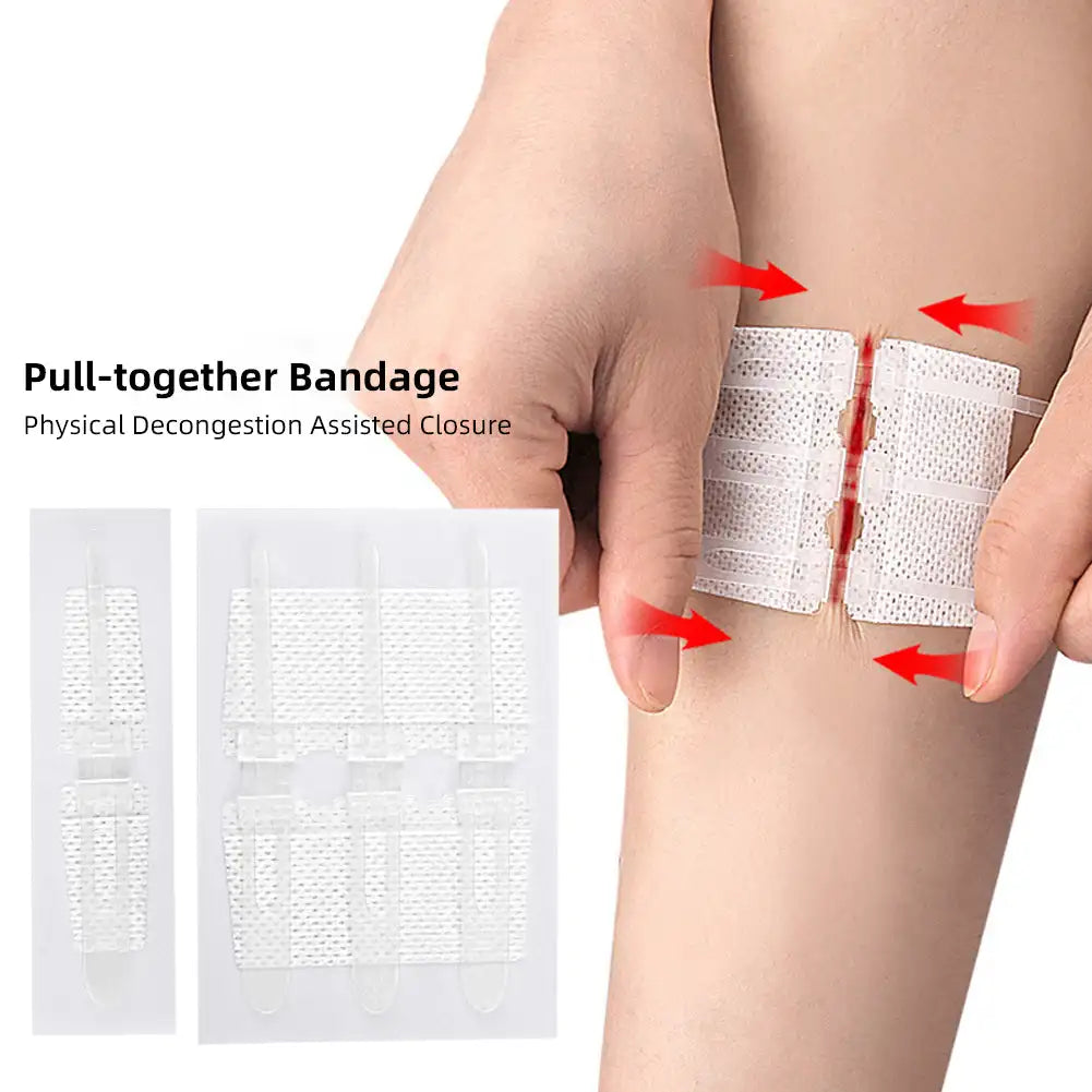 Emergency Laceration Closure Strips
