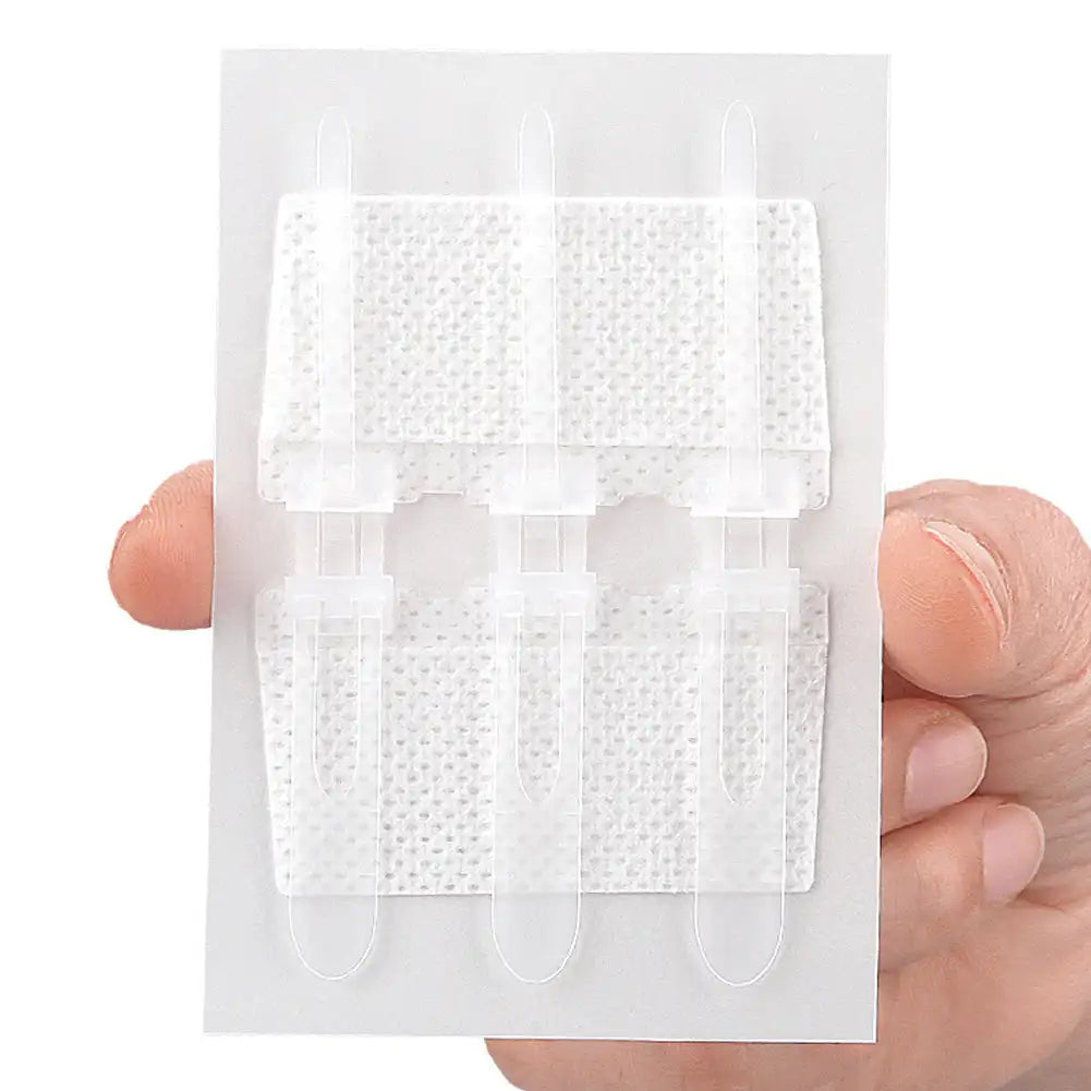 Emergency Laceration Closure Strips