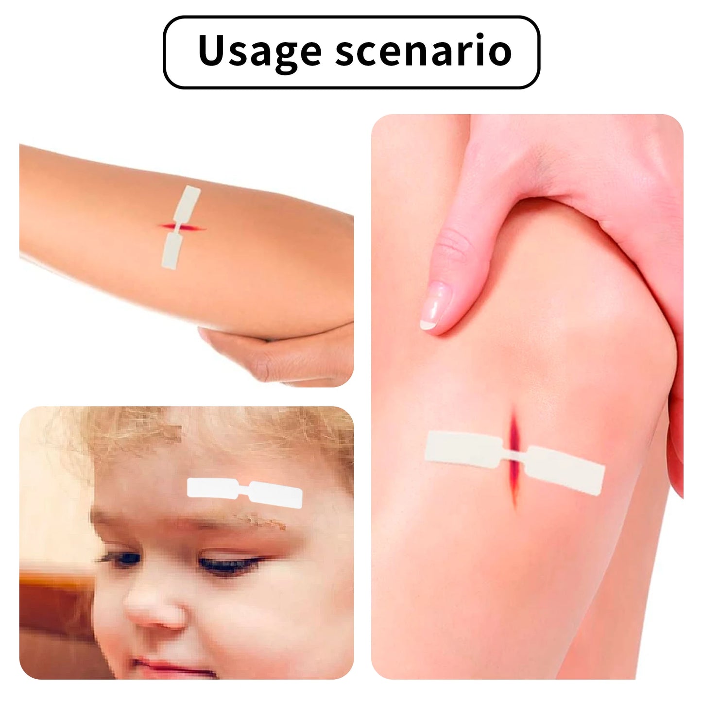 MediSeal 120PCS Waterproof Butterfly Bandages