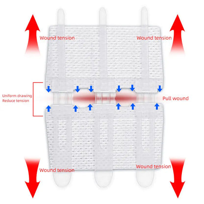 Emergency Laceration Closure Strips