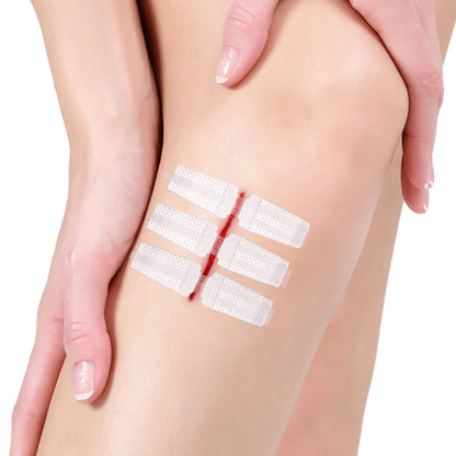 Emergency Laceration Closure Strips
